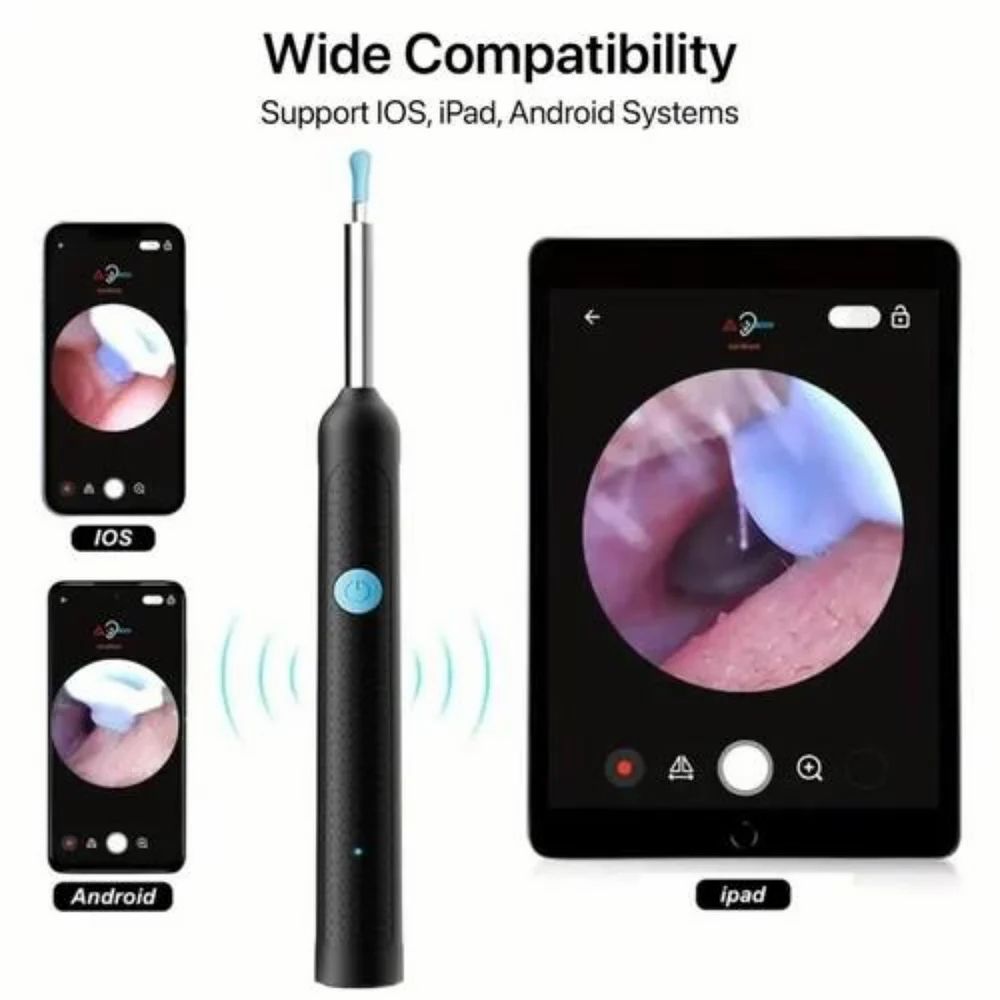 Smart Visual Earwax Cleaner