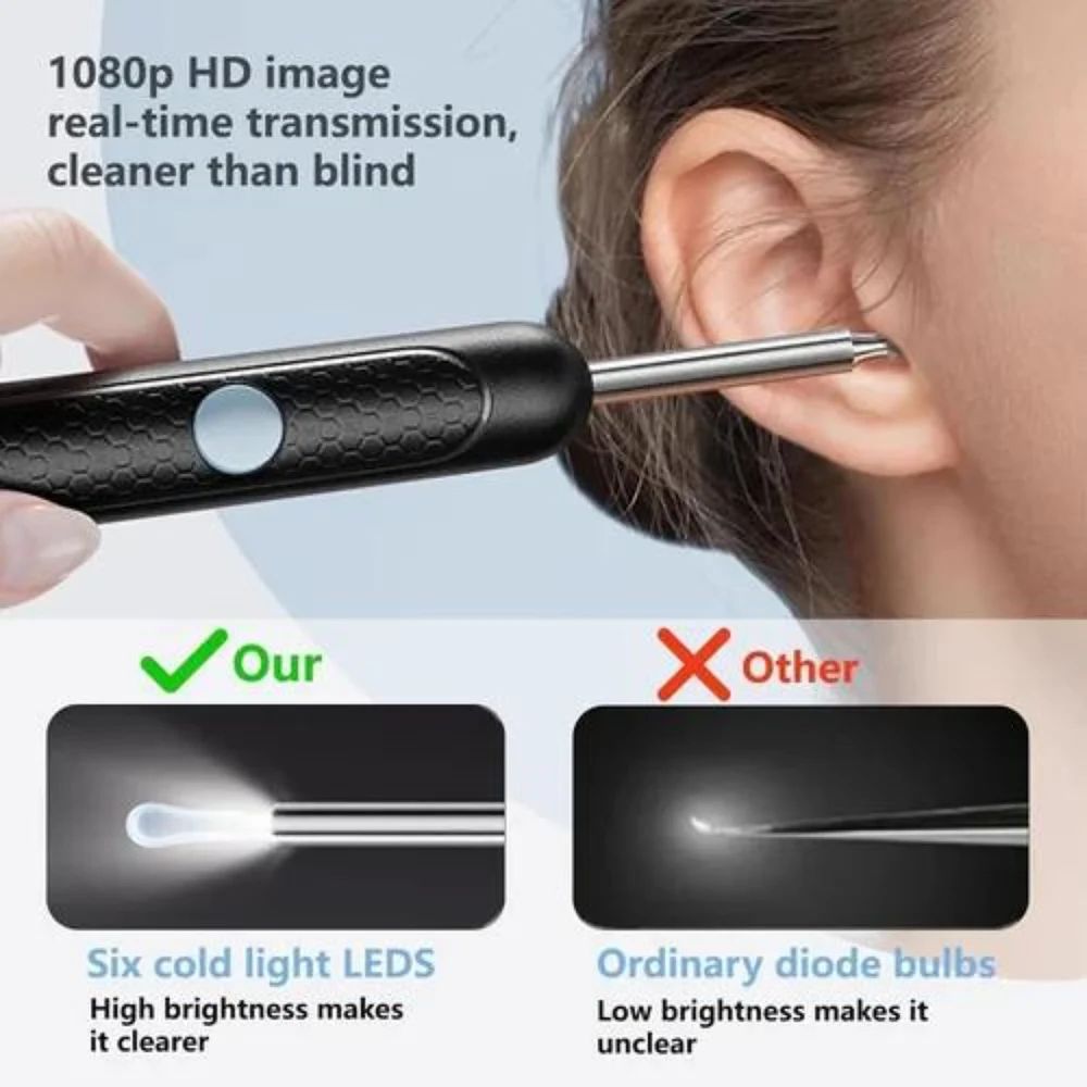 Smart Visual Earwax Cleaner